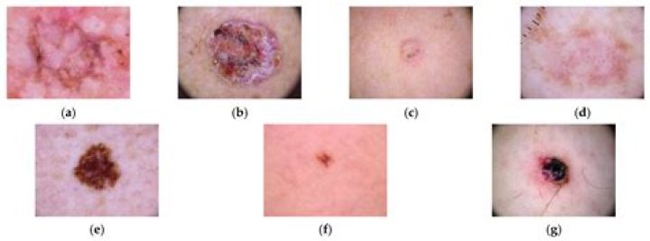 Are Remsima and INFLECTRA the same?