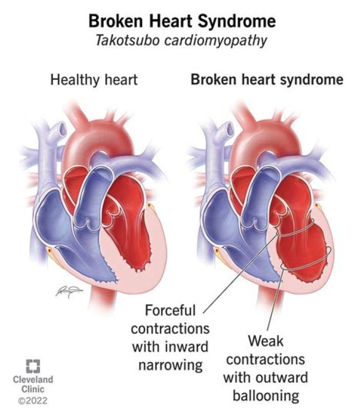 Can broken heart Be Fixed?