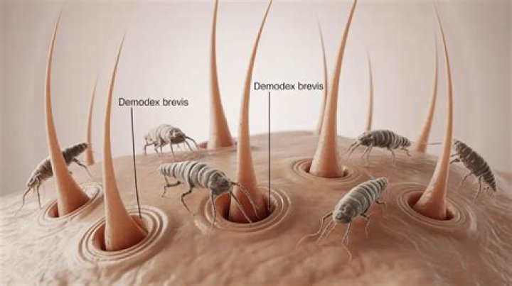 Can humans get ear mites in their hair?