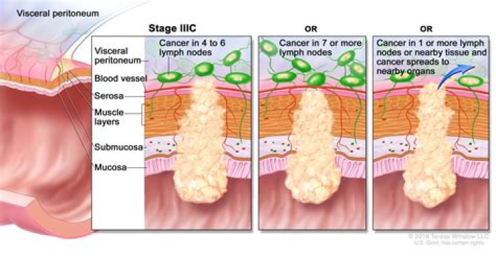 Can meningeal carcinomatosis be cured?