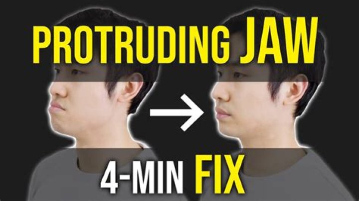 Can you fix a protruding jaw?