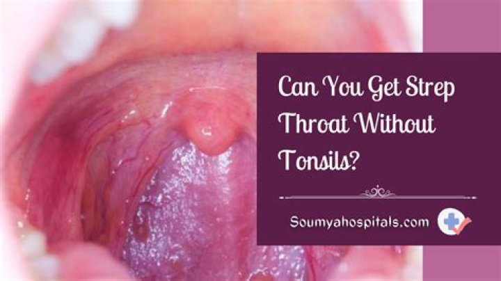 Can you still get a sore throat without tonsils?