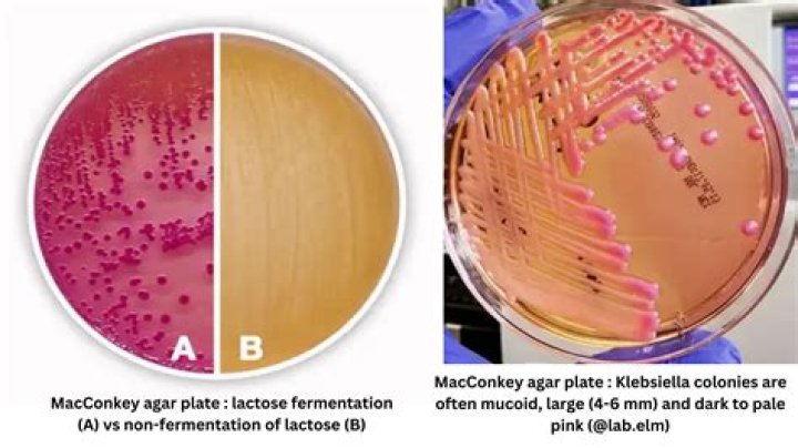 Do coliforms grow on EMB agar?
