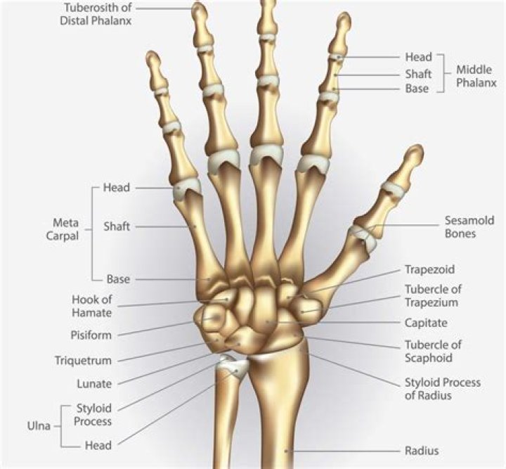 How do I know if I broke a bone in my hand?