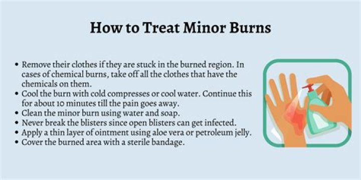 How do you treat a burner?