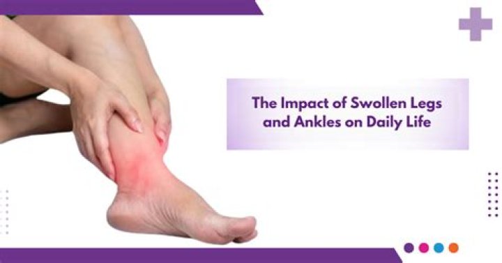How do you treat swollen ankles in horses?