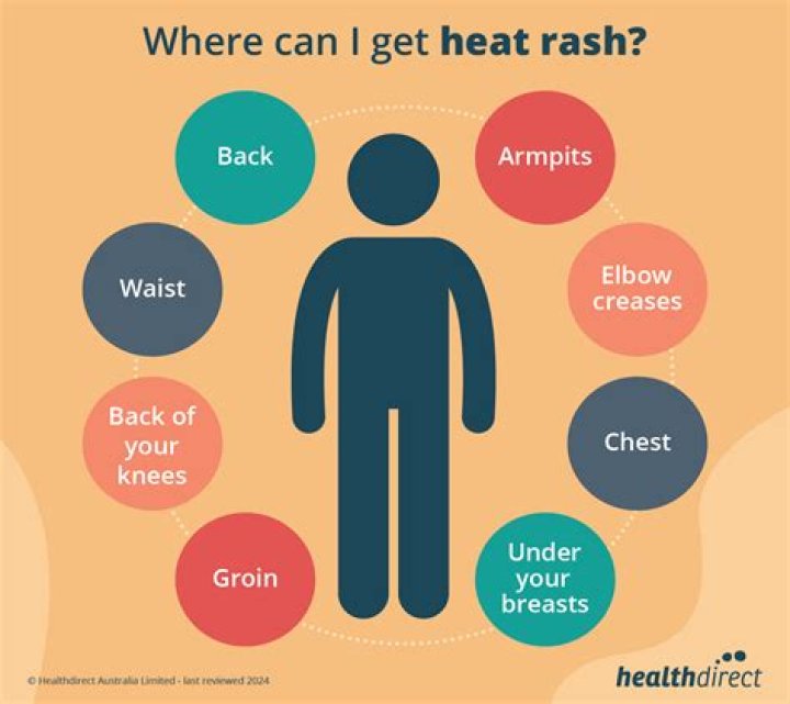 How long does heat rash take to go away?
