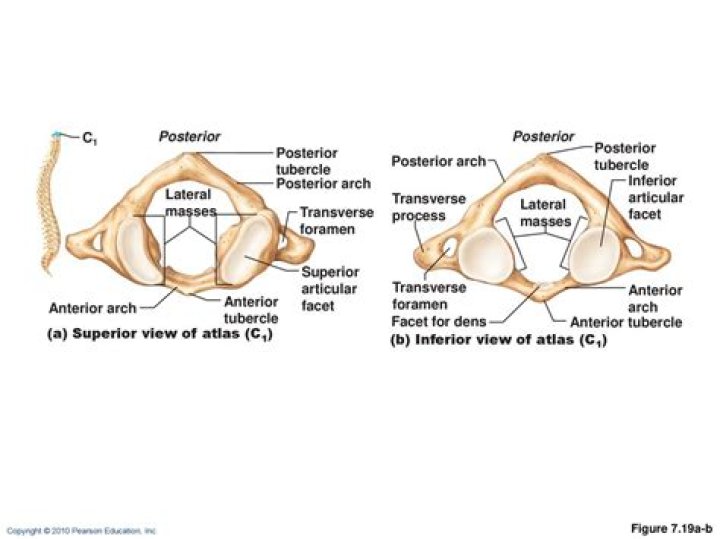 How we can distinguish anterior and posterior arches of atlas?