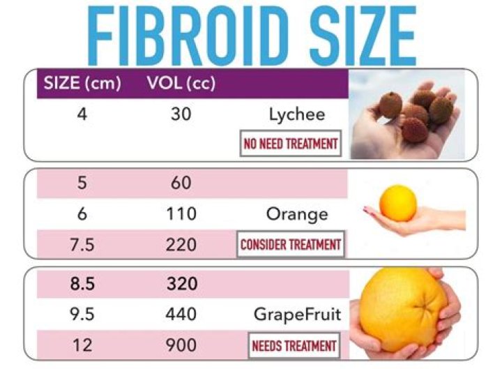 Is a 4cm fibroid large?
