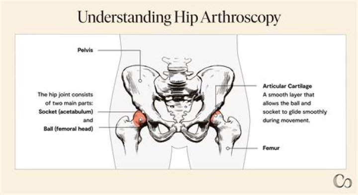Is an arthrogram MRI painful?
