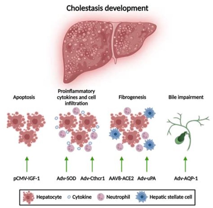 Is cholestasis a hepatitis?
