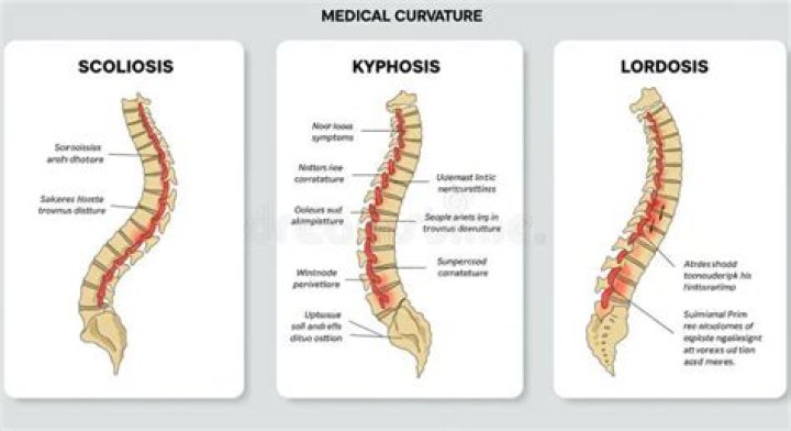 What are the 3 types of abnormal spinal curvatures?