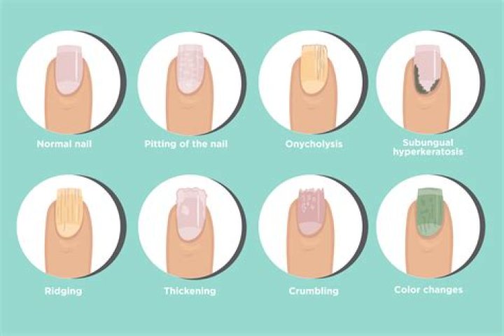 What causes fingernails to stop growing?