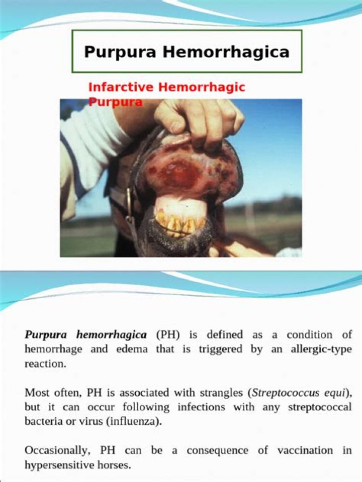 What causes purpura Hemorrhagica?