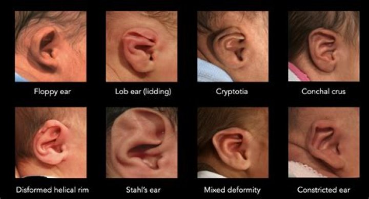 What cultures Pierce babies ears?