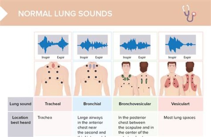 What do wheezing lung sounds indicate?