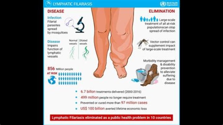 What does elephantiasis look like?