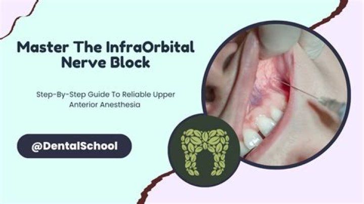 What does the infraorbital block affect?