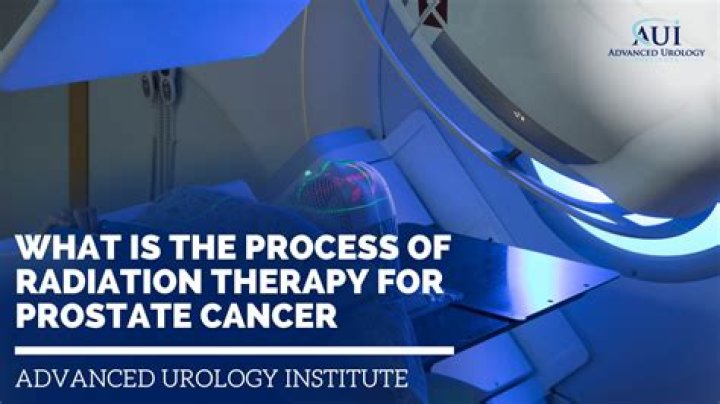 What is a simulation for radiation treatment?