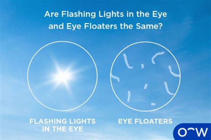 What is flashing lights in eyes a symptom of?