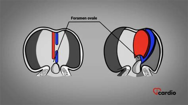 What is foramen ovale and where it is found?