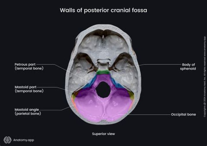 What is posterior fossa malformations?