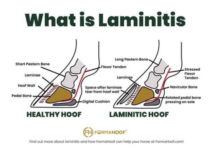 What is the best treatment for laminitis?