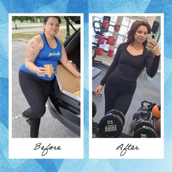 What is the best weight loss surgery in Australia?