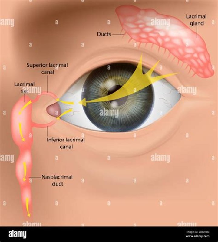 Which condition is an inflammation of the lacrimal gland?