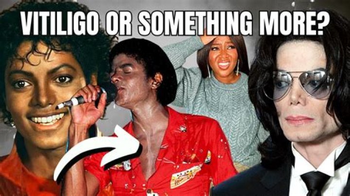 Why did Michael Jackson change his voice?