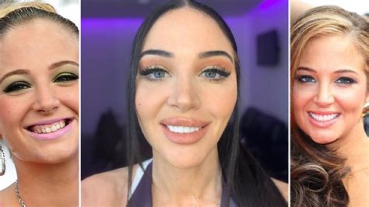 Why did Tulisa ruin her face?