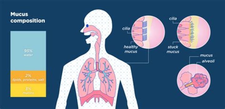 Why does mucus build up in the airways of patients with cystic fibrosis?