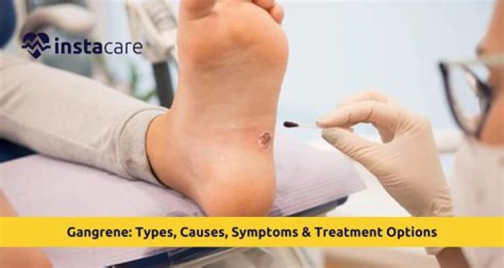 Why is amputation necessary for gangrene?
